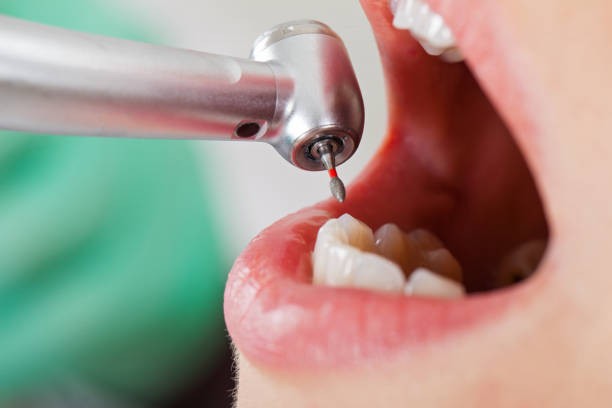 Best Broken Tooth Emergency  in Latta, SC